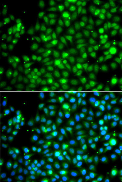 Metabolism Antibodies 2 Anti-NME2 Antibody CAB7443