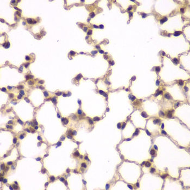 Cell Biology Antibodies 11 Anti-PIP4K2A Antibody CAB7446