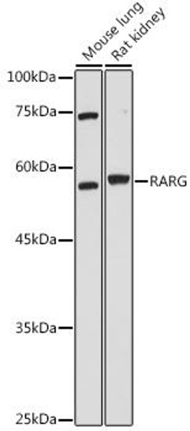 Epigenetics and Nuclear Signaling Antibodies 4 Anti-RARG Antibody CAB7448