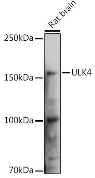 Cell Biology Antibodies 11 Anti-ULK4 Antibody CAB7471