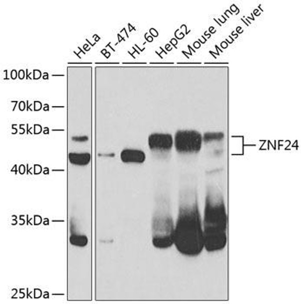 Epigenetics and Nuclear Signaling Antibodies 4 Anti-ZNF24 Antibody CAB7500