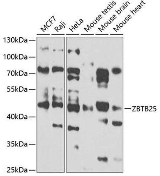 Epigenetics and Nuclear Signaling Antibodies 4 Anti-ZBTB25 Antibody CAB7501