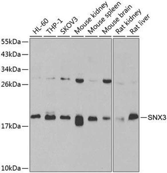 Cell Biology Antibodies 11 Anti-SNX3 Antibody CAB7502