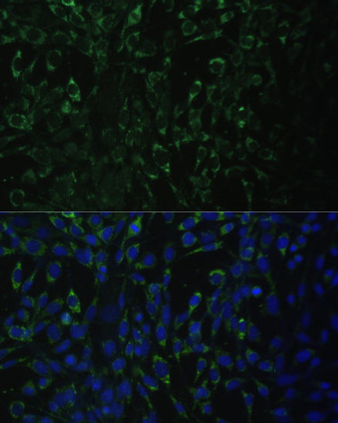 Cell Biology Antibodies 11 Anti-ALDH1A2 Antibody CAB7503