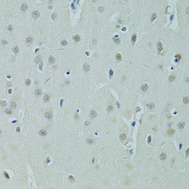 Cell Biology Antibodies 11 Anti-ZNF346 Antibody CAB7507