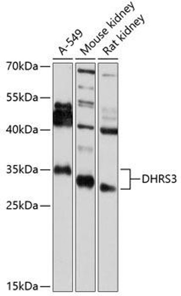 Cell Biology Antibodies 11 Anti-DHRS3 Antibody CAB7530