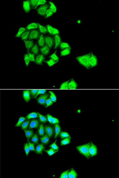 Epigenetics and Nuclear Signaling Antibodies 4 Anti-Rad51D Antibody CAB7534