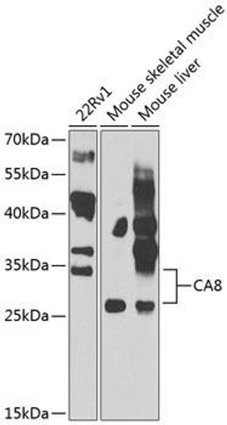 Cell Biology Antibodies 11 Anti-CA8 Antibody CAB7544