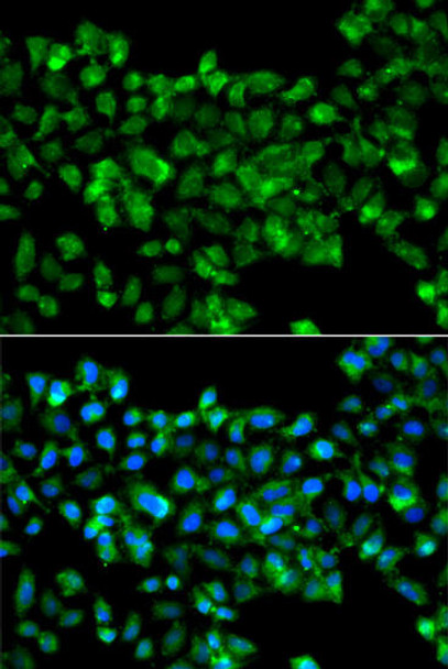 Cell Biology Antibodies 11 Anti-CBR3 Antibody CAB7545