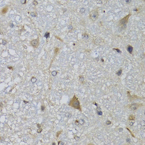 Neuroscience Anti-CHN1 Antibody CAB7546