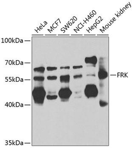 Cell Biology Antibodies 11 Anti-FRK Antibody CAB7556