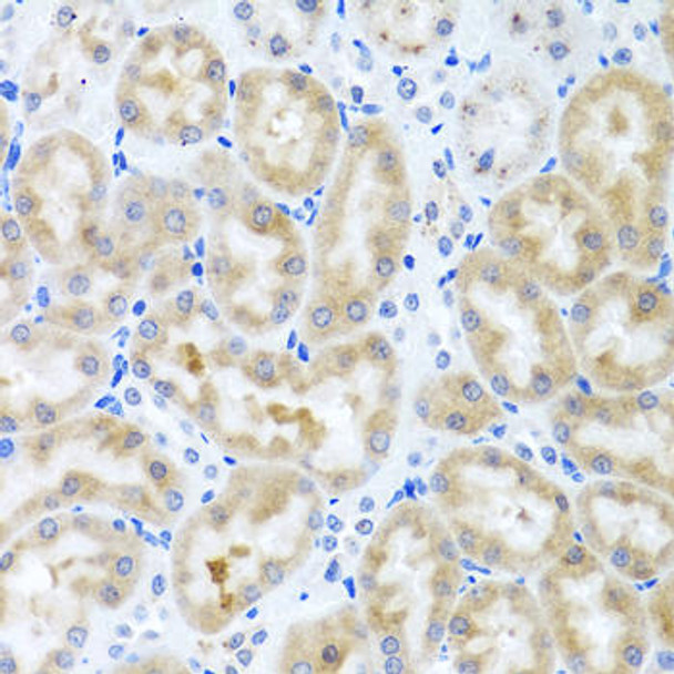 Cell Biology Antibodies 11 Anti-INHBC Antibody CAB7559