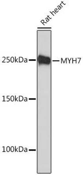 Cell Biology Antibodies 11 Anti-MYH7 Antibody CAB7564