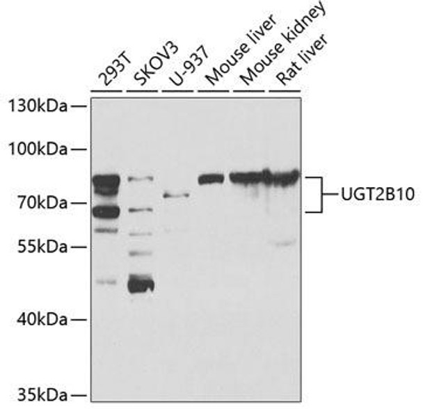 Cell Biology Antibodies 11 Anti-UGT2B10 Antibody CAB7570