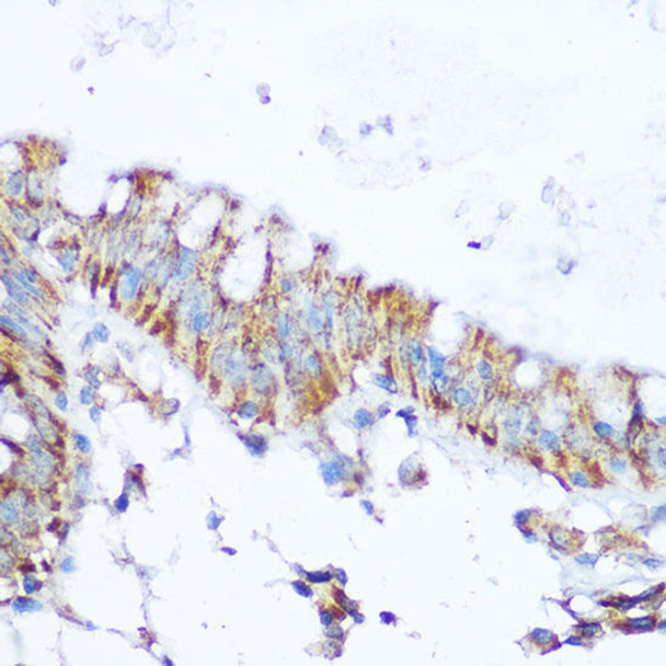 Epigenetics and Nuclear Signaling Antibodies 4 Anti-SIRT4 Antibody CAB7585