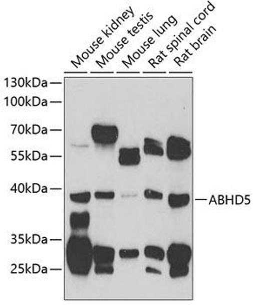 Developmental Biology Anti-ABHD5 Antibody CAB7592
