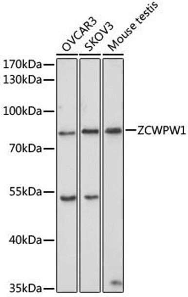 Cell Biology Antibodies 11 Anti-ZCWPW1 Antibody CAB7596