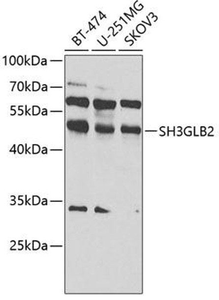 Cell Biology Antibodies 11 Anti-SH3GLB2 Antibody CAB7599