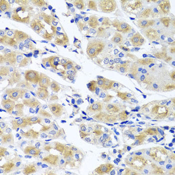 Cell Biology Antibodies 11 Anti-SPATA4 Antibody CAB7608