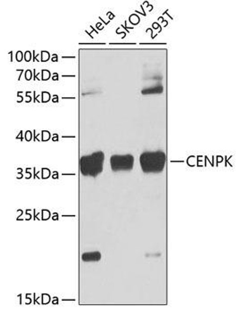 Cell Biology Antibodies 11 Anti-CENPK Antibody CAB7627