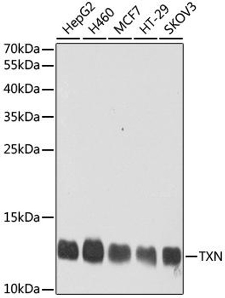 Cell Biology Antibodies 11 Anti-TXN Antibody CAB7638