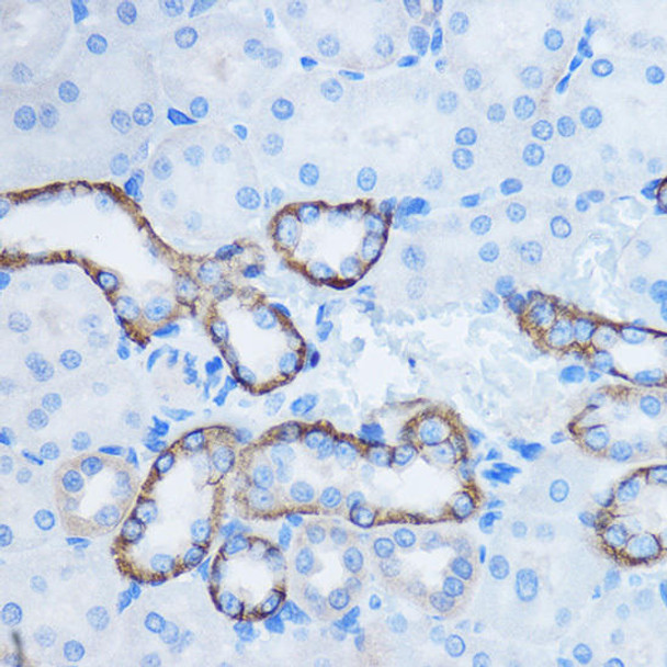 Cell Biology Antibodies 11 Anti-YWHAZ Antibody CAB7639