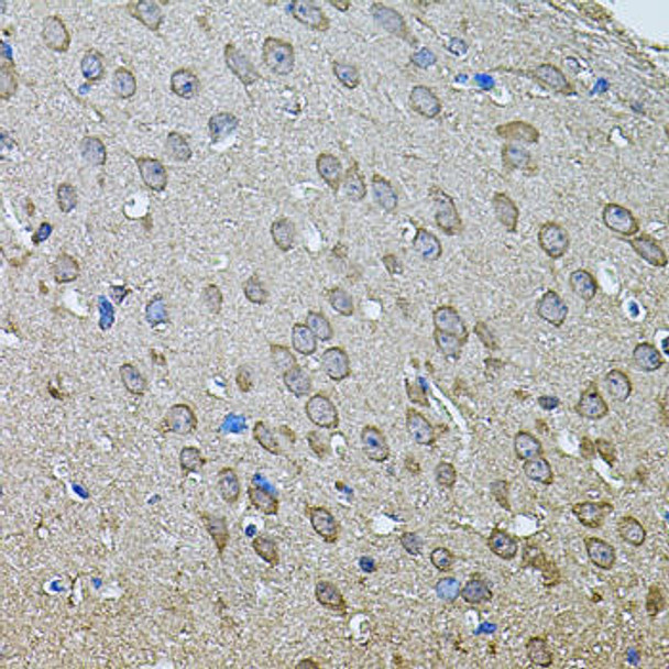 Cell Biology Antibodies 11 Anti-ANXA8L2 Antibody CAB7641