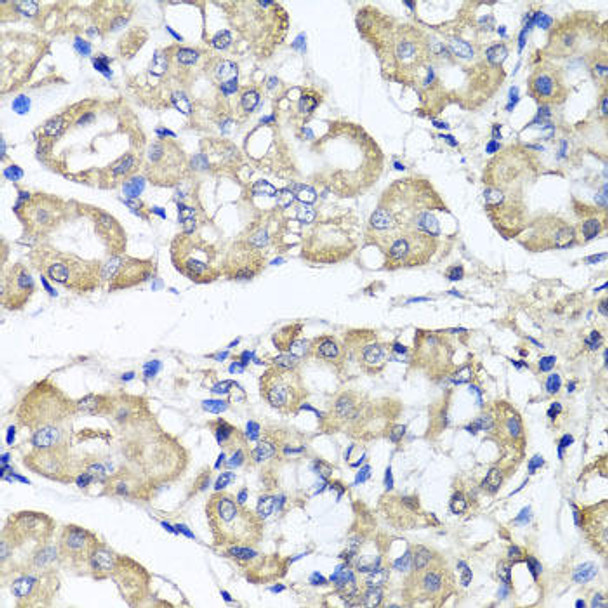 Cell Biology Antibodies 11 Anti-BCS1L Antibody CAB7647