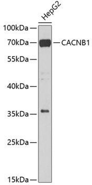 Cell Biology Antibodies 11 Anti-CACNB1 Antibody CAB7649