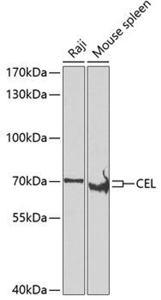 Metabolism Antibodies 2 Anti-CEL Antibody CAB7652