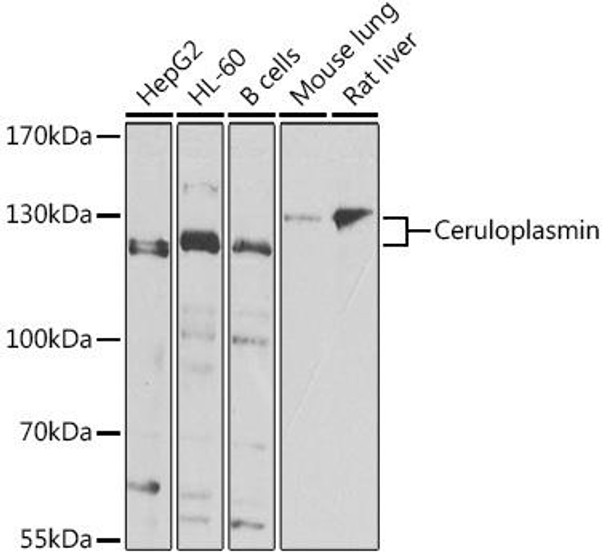 Cell Biology Antibodies 11 Anti-Ceruloplasmin Antibody CAB7658