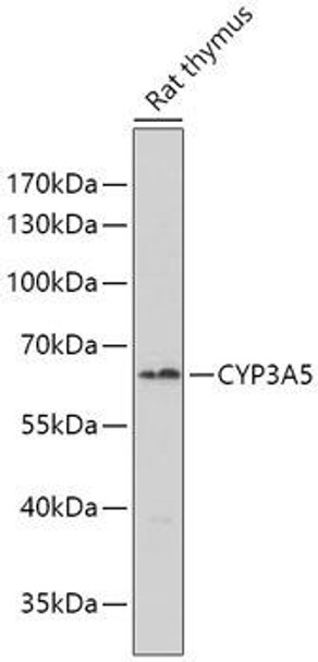 Metabolism Antibodies 2 Anti-CYP3A5 Antibody CAB7663