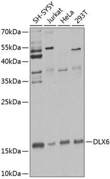 ChIP Antibodies Anti-DLX6 Antibody CAB7667