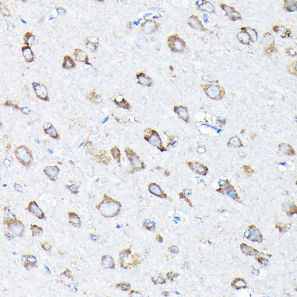 Cell Biology Antibodies 11 Anti-ETFA Antibody CAB7670