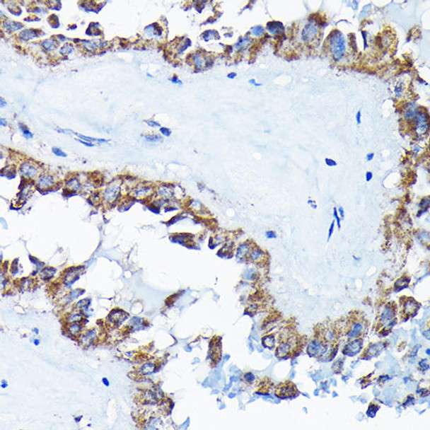 Cell Biology Antibodies 11 Anti-ETFA Antibody CAB7670