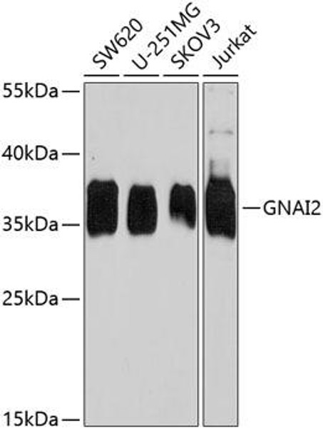 Cell Cycle Antibodies 2 Anti-GNAI2 Antibody CAB7676