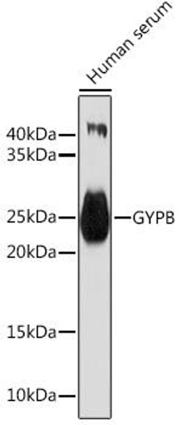 Cell Biology Antibodies 11 Anti-GYPB Antibody CAB7682
