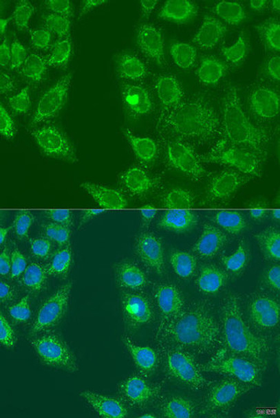 Metabolism Antibodies 2 Anti-HSD17B3 Antibody CAB7687