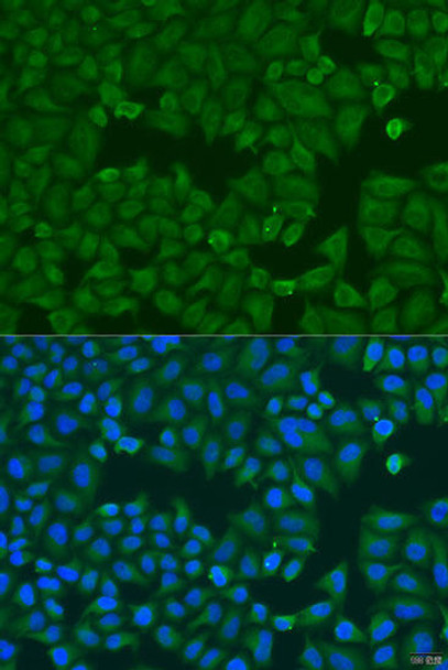 Cell Biology Antibodies 11 Anti-KRT6B Antibody CAB7696