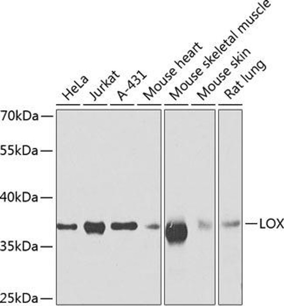 Cell Biology Antibodies 11 Anti-LOX Antibody CAB7698