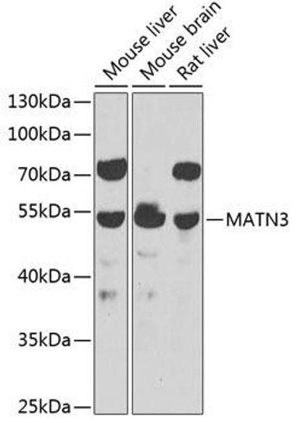 Cell Biology Antibodies 11 Anti-MATN3 Antibody CAB7700
