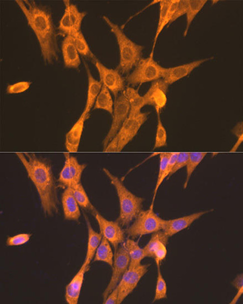 Metabolism Antibodies 2 Anti-PFKL Antibody CAB7708