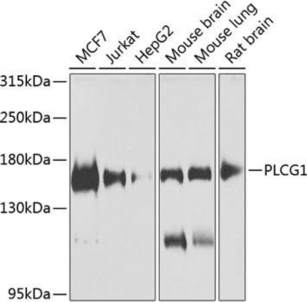 Immunology Antibodies 2 Anti-PLCG1 Antibody CAB7711