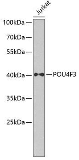 Developmental Biology Anti-POU4F3 Antibody CAB7712