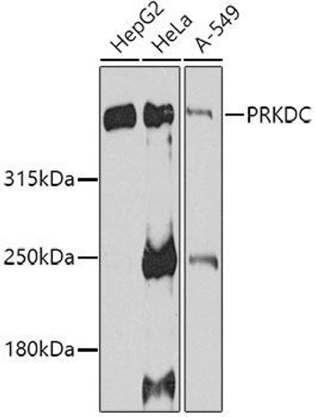 Cell Biology Antibodies 11 Anti-PRKDC Antibody CAB7716