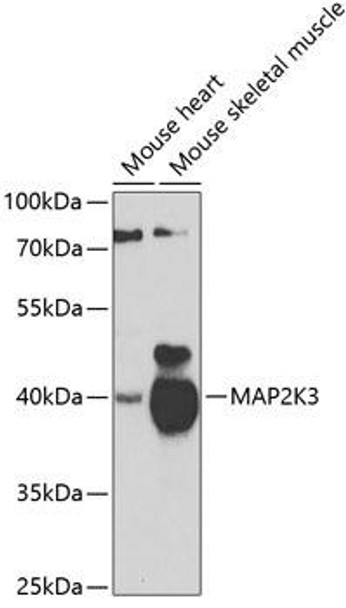 Cell Biology Antibodies 11 Anti-MAP2K3 Antibody CAB7718