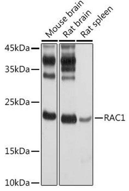 Cell Biology Antibodies 11 Anti-RAC1 Antibody CAB7720