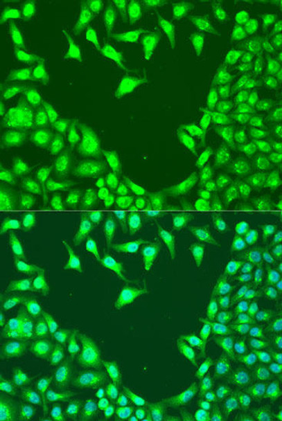 Cell Death Antibodies 2 Anti-MAP2K4 Antibody CAB7724