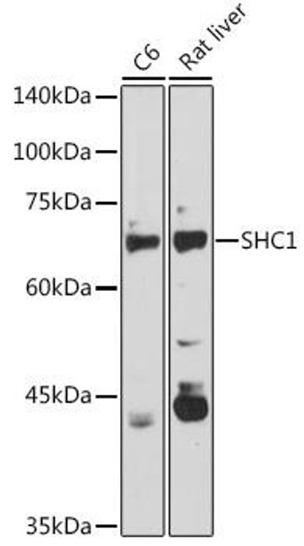Cardiovascular Antibodies Anti-SHC1 Antibody CAB7725