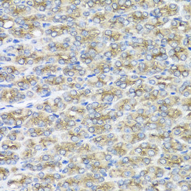 Cell Biology Antibodies 11 Anti-STXBP2 Antibody CAB7735